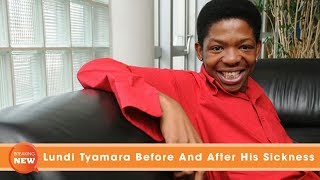 Lundi Tyamara Before And After His Sickness [upl. by Annairba558]