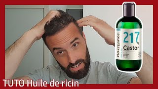 FAIRE POUSSER LES CHEVEUX PLUS VITE 😍😍POTION ACTIVATEUR DE POUSSE [upl. by Wulfe]