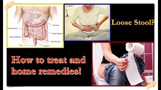 Loose Stool – Causes Treatment Home Remedies [upl. by Auhsaj]