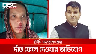 ইউপি সদস্যকে মেরে দাঁত ফেলে দিলেন চেয়ারম্যান  DBC NEWS Special [upl. by Zoba803]