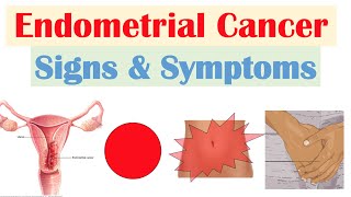 Endometrial Cancer Signs amp Symptoms amp Why They Occur [upl. by Nobe]