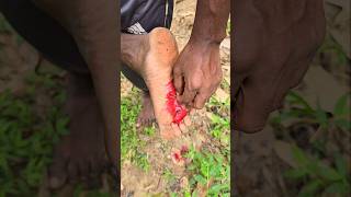 Survival Skills  Simple but Very Useful with plastic bottle shorts viralvideo ytshorts [upl. by Wimsatt76]