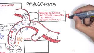 Malaria Pathophysiology [upl. by Absa]