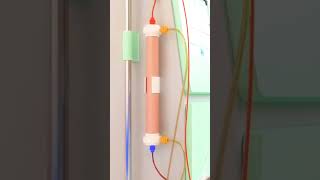 dialysis process animation dialysistechnician kidney bloodcleanser [upl. by Eustacia]