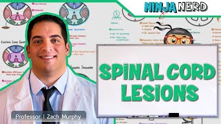 Spinal Cord Lesions [upl. by Ahsha]