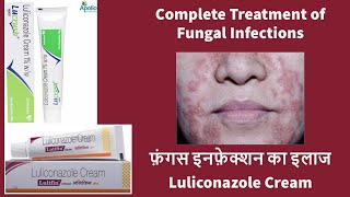 Lucrush Cream review जांघों के बीच फंगल Infection के लिए special और safest Cream Luliconazole Cream [upl. by Egreog]