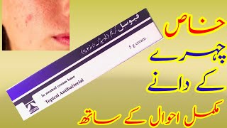 Fusil cream ueses in urdu hindi  fusidic acid sideffects 2024 Healthcaremedicalinfo [upl. by Cicero]