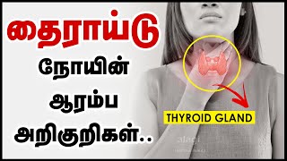 தைராய்டு நோய் அறிகுறிகள்  Thyroid Symptoms in Tamil  Signs of Thyroid Problems  Thyroid Disease [upl. by Corneille607]