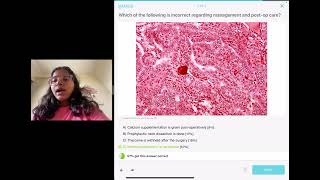 thyroid carcinoma part 2 [upl. by Aiden]