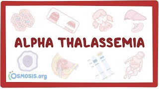 Alphathalassemia  an Osmosis Preview [upl. by Asennav209]