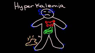 Hyperkalemia [upl. by Dove809]