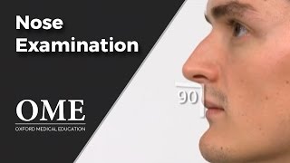 Nose Examination Inspection  ENT [upl. by Ihana]