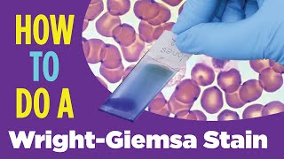 How to do a hematology stain WrightGiemsa stain Laboratory Tutorial Procedure [upl. by Wavell]