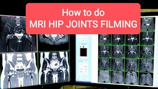 MRI Hip Joints Filming Protocol [upl. by Drwde]