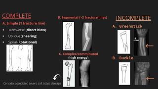 Hip Fracture Types amp Fixation  Everything You Need To Know  Dr Nabil Ebraheim [upl. by Assyl]