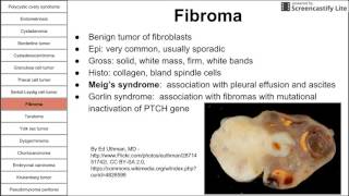 Ovarian pathology [upl. by Gasser]