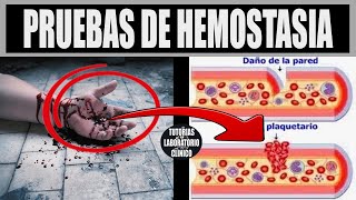 🩸Pruebas de la Hemostasia Primaria y Secundaria  ¿Que son ¿para qué Sirven y ¿cómo se realizan❤️ [upl. by Anwahsal]