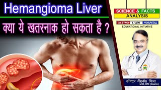 HEMANGIOMA LIVER क्या ये ख़तरनाक हो सकता है   LIVER HEMANGIOMA [upl. by Ninette]