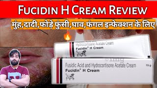 Fucidin Ointment Sodium fusidate ointment Fucidin Ointment uses side effects and benefits [upl. by Iuqcaj558]