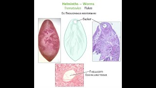 Trematodes Worms leaf like Flukes  Types Diseases Symptoms Diagnosis Treatment [upl. by Esiuqram]