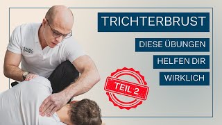 Trichterbrust Diese Übungen können dir helfen Teil 2 [upl. by Angell]