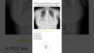 Chest Xray Buzz 18 radiologychannel007 [upl. by Leno]