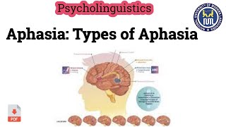 Aphasia  Types of Aphasia [upl. by Niawat]