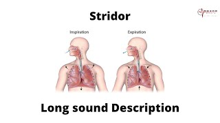 Stridor  Lung sound description  Upper airway obstruction [upl. by Malkin]