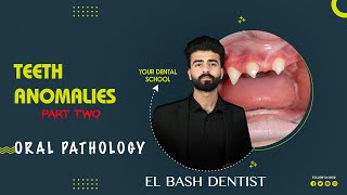 developmental anomalies  teeth anomalies 2  oral pathology عزت شومان [upl. by Macswan]