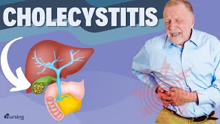 Cholecystitis Causes and Assessment Nursing [upl. by Conroy149]