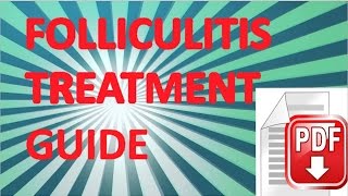 Folliculitis Treatment Guide and Advice [upl. by Arrim178]