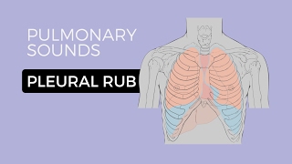 05  Lung Sounds  Pleural friction rub 🎧 [upl. by Llenaj]