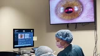 Live PRK Procedure at Commonwealth Eye Surgery [upl. by Fremont116]