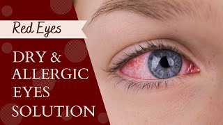 Drops For Red Eyes Pain  Dry Eyes Treatment [upl. by Mann]