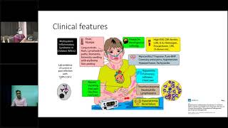 Multisystem inflammatory syndrome in children MIS C Dr Suresh Kumar Angurana Division of Pediatri [upl. by Philender266]