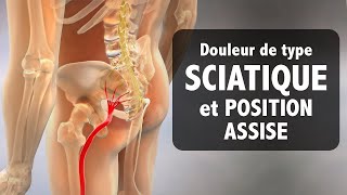 Douleur de type SCIATIQUE et position assise des conseils pour un soulagement durable [upl. by Brose]