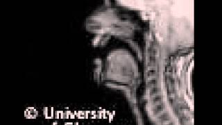 MRI voiced alveolar lateralapproximant [upl. by Enedan]