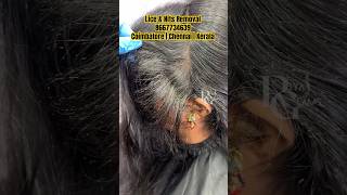 Lice damage hairhow to remove lice from hairlice and nits removallice in baby hairlice removal [upl. by Goldston]