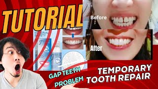 Tutorial How to use Moldable False teeth [upl. by Grinnell]