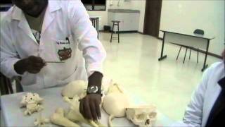 Anatomia  Ossos e Acidentes dos Ossos  Maurício  UNIANDRADE [upl. by Shari]