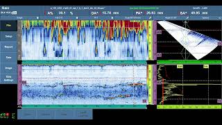 PAUT Phased array Ultrasonic Testing Data Interpretation [upl. by Demmy539]