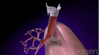 Bronchitis Animation [upl. by Alolomo]