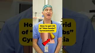 How to get rid of man boobs Gynecomastia [upl. by Ecirahc247]