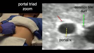 CT VS MRI  How to Identify and Difference [upl. by Trent602]