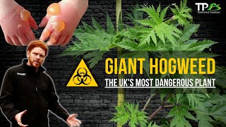 Giant Hogweed  The UKs Most Dangerous amp Toxic Plant [upl. by Elyag951]