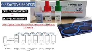 CRP Test Procedure ll How to Do Qualitative amp Semi Quantitative Test Procedure [upl. by Neetsyrk]