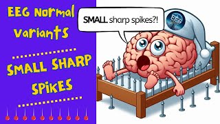 Small Sharp Spikes  Normal EEG Basics [upl. by Landers]