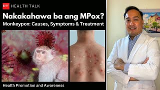 Nakakahawa ba ng Mpox Monkeypox Causes risk factors symptoms treatment and prevention [upl. by Perlis]