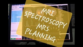 BANGLA MRI SPECTROSCOPY MRS PALNNING amp PROCESSING ON PHILIPS SOFTWARE 3T MRIPHILIPS3T [upl. by Riorsson]