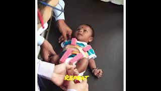 How to wear Pavlik harness in a child with hip problem [upl. by Haianeb]